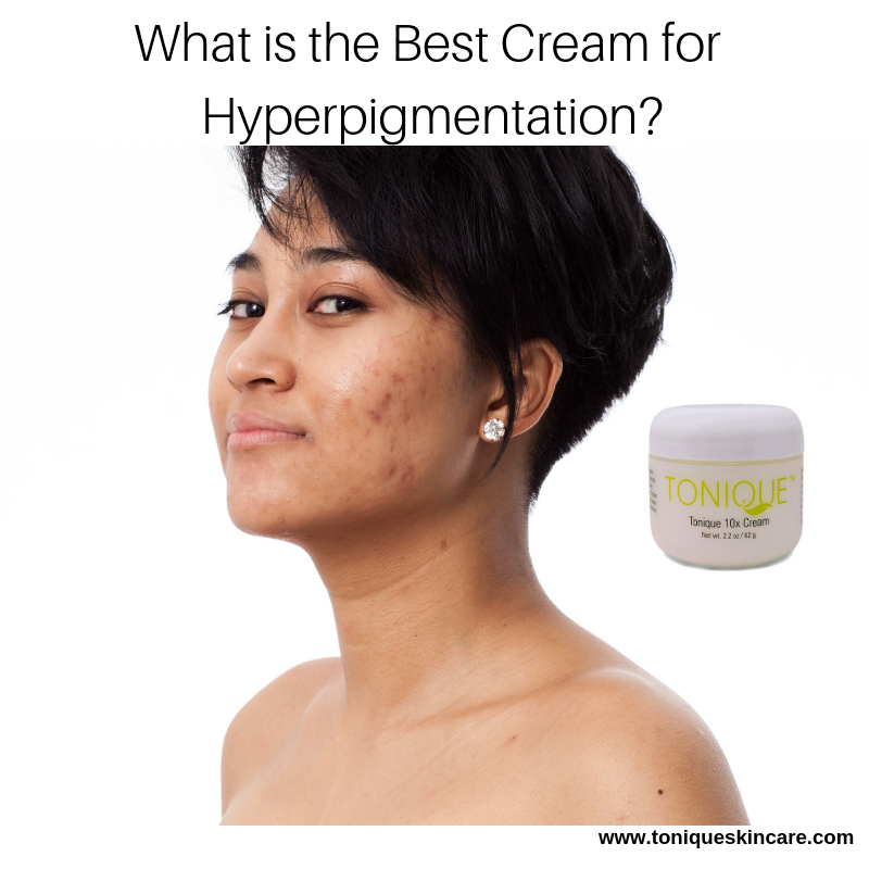 Best cream deals for hyperpigmentation