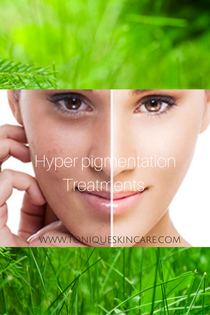 Hyperpigmentation Treatments